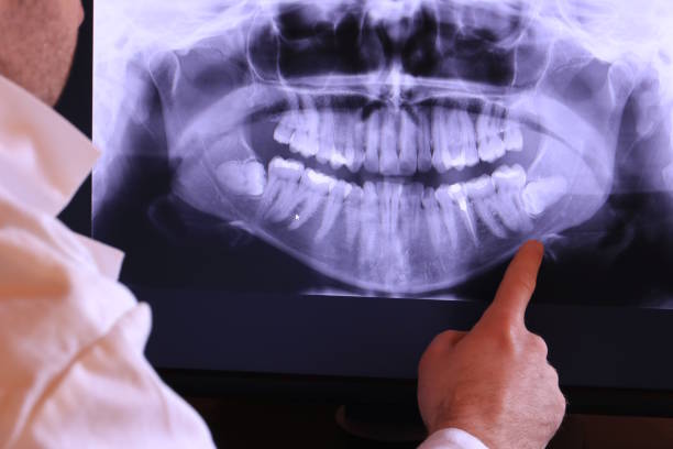 Best Emergency Tooth Extraction in Crescent City, CA